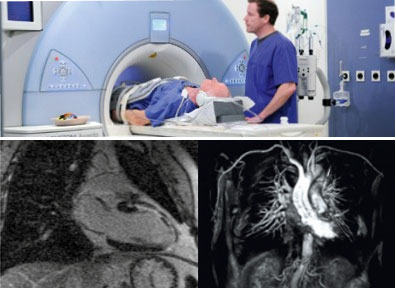 МРТ сердца в Германии